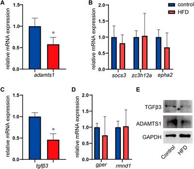 Identification of polyunsaturated fatty acids related key modules and genes in metabolic dysfunction-associated fatty liver disease using WGCNA analysis